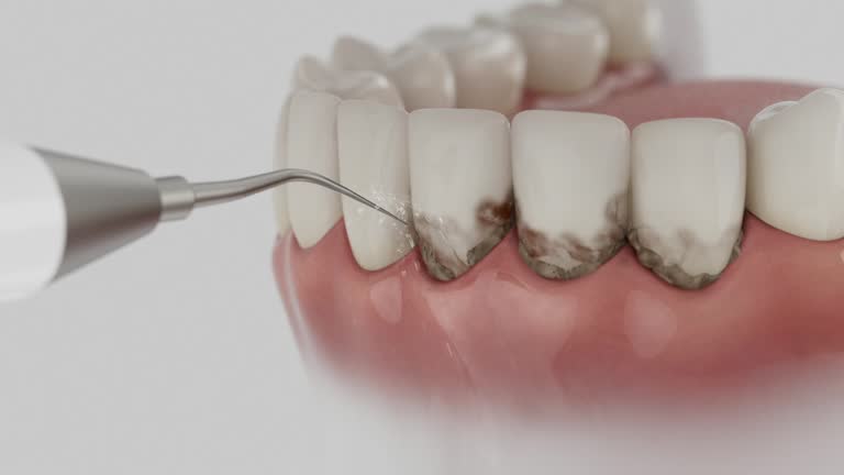 Reliable Dental contractor in Greenfield, MN by Smile Center Dentistry